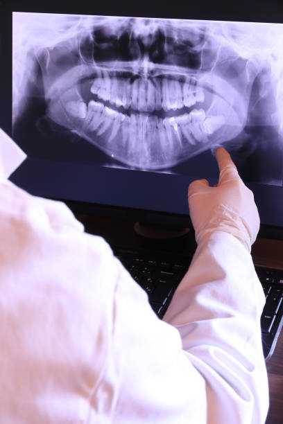 Best Knocked-Out Tooth Emergency  in Continental, OH